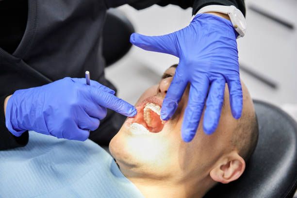 Best Chipped Tooth Repair Near Me  in Woodville, WI
