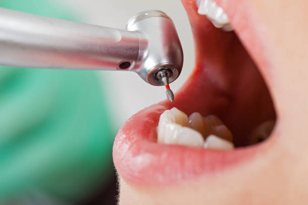Best Broken Tooth Emergency  in Woodville, WI
